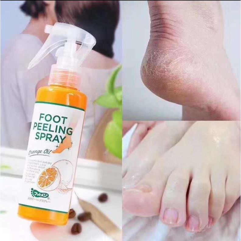 [2chai] ✨TẨY TẾ BÀO CHẾT CHÂN, KHUỶU TAY, ĐẦU GỐI DẠNG XỊT FOOT PEELING SPRAY ORANGE OIL✨