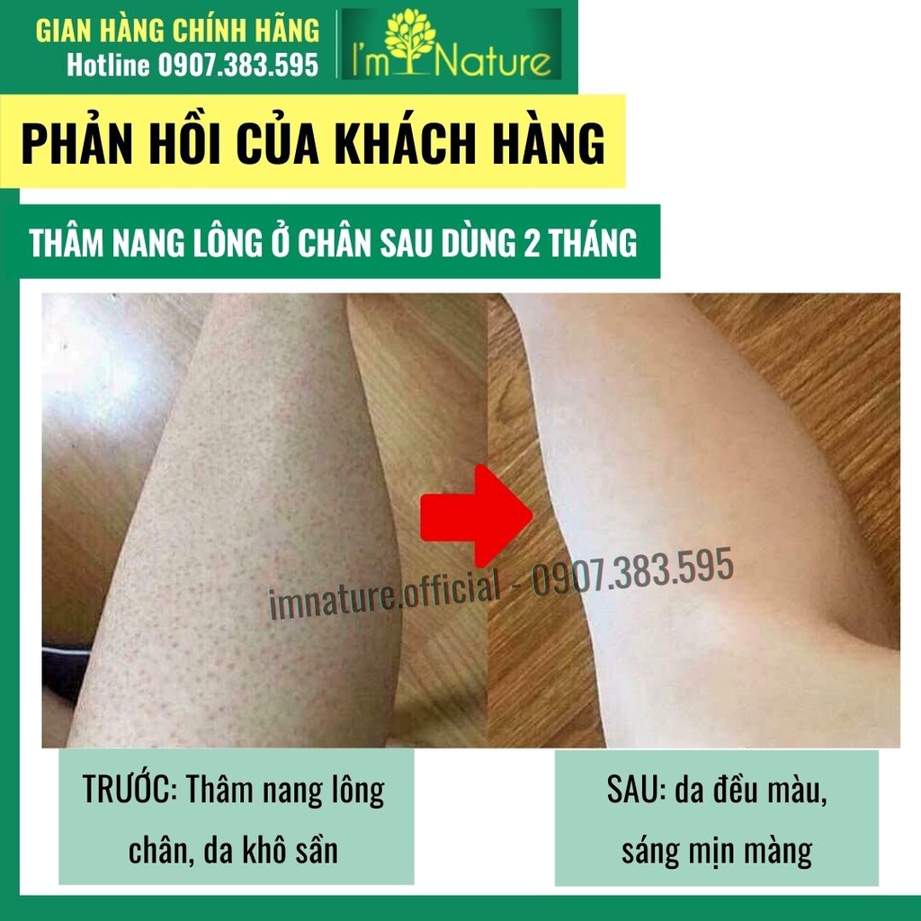 Muối Tắm Giảm Mụn Lưng - Ngừa Rôm Sảy - Thâm Nang Lông Với Tinh Chất Muối Biển Tràm Trà 220gr  I’m Nature