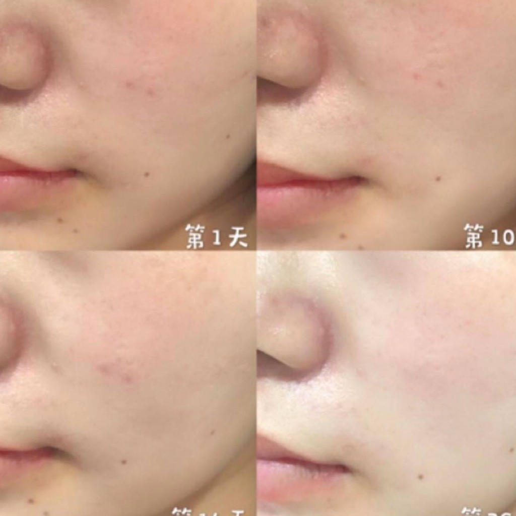 Tinh Chất Cô Đặc Estee Lauder  Advanced Night Repair Intense Reset Concentrate Mini 5ml