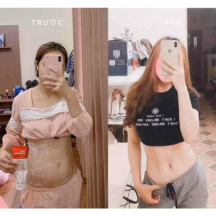 Gel/Kem Tan Mỡ Missha Hàn Quốc Chính Hãng Hiệu Quả Giảm Mỡ Rõ Rệt