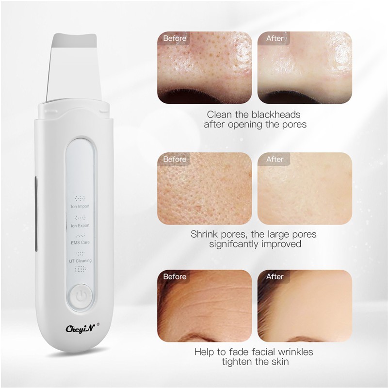 Máy chăm sóc da CKEYIN MR523 sóng siêu âm EMS làm sạch mụn đầu đen lỗ chân lông loại bỏ nếp nhăn tẩy trang