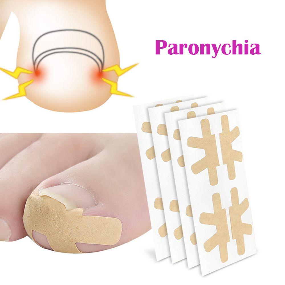 Miếng Dán Sửa Chữa Móng Chân Chống Nước Tiện Dụng