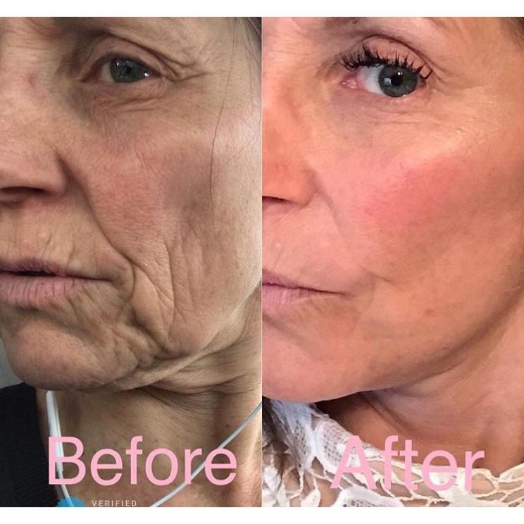 Big Gel 60 Cặp Facial Galvanic Nuskin