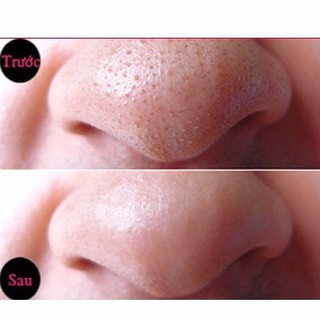 [Hàng có sẵn, có bill] Gel lấy mụn đầu đen Tsururi