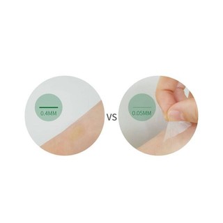GEL CHE MỤN REAL SKIN PATCH  NOT4