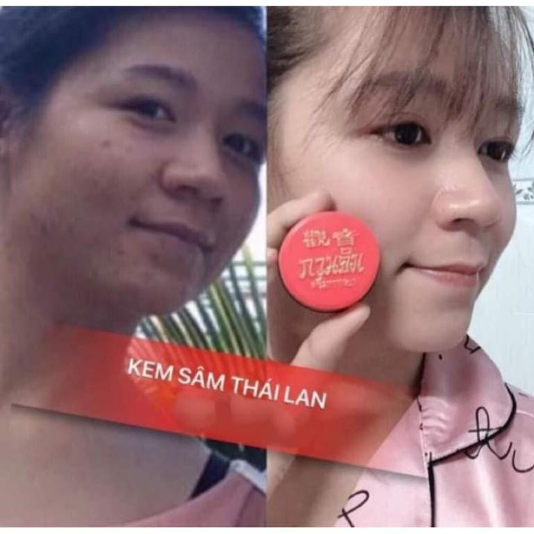 KEM SA.M 5IN1 THÁI LAN