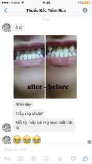 [SALE] Miếng dán trắng răng Crest Supreme
