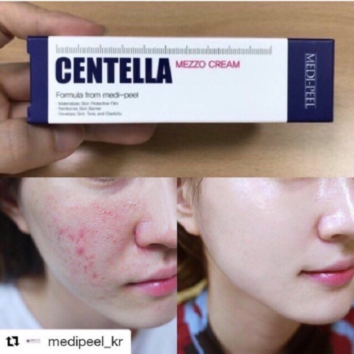 Kem dưỡng Medi-Peel Centella Mezzo Cream 30ml giúp giảm mụn, phục hồi da, làm dịu da.