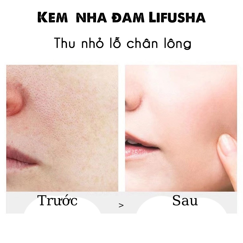 Gel nha đam ☀️ 𝐒𝐀𝐋𝐄 𝐒𝐀̣̂𝐏 𝐒𝐀̀𝐍 ☀️ LIFUSHA,dưỡng ẩm,làm dịu da