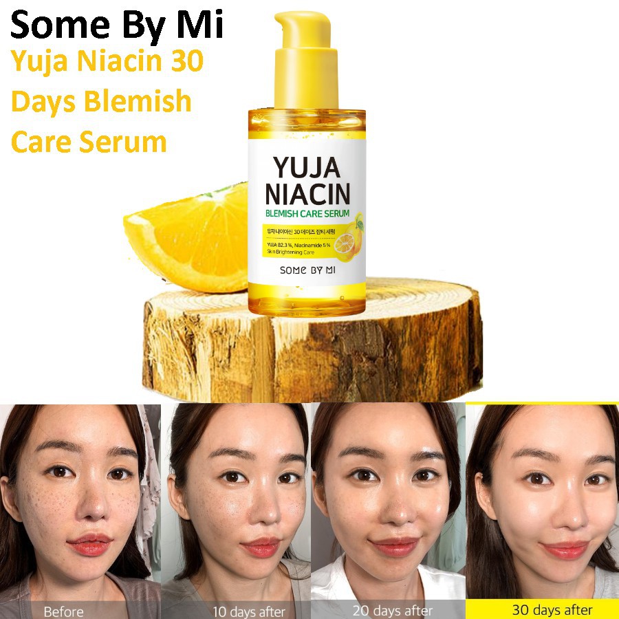 [Hàng Công Ty] Serum Trắng Da Mờ Thâm Mụn Hiệu Quả - Some By Mi Yuja Niacin 30 Days Blemish Care Serum 50ml