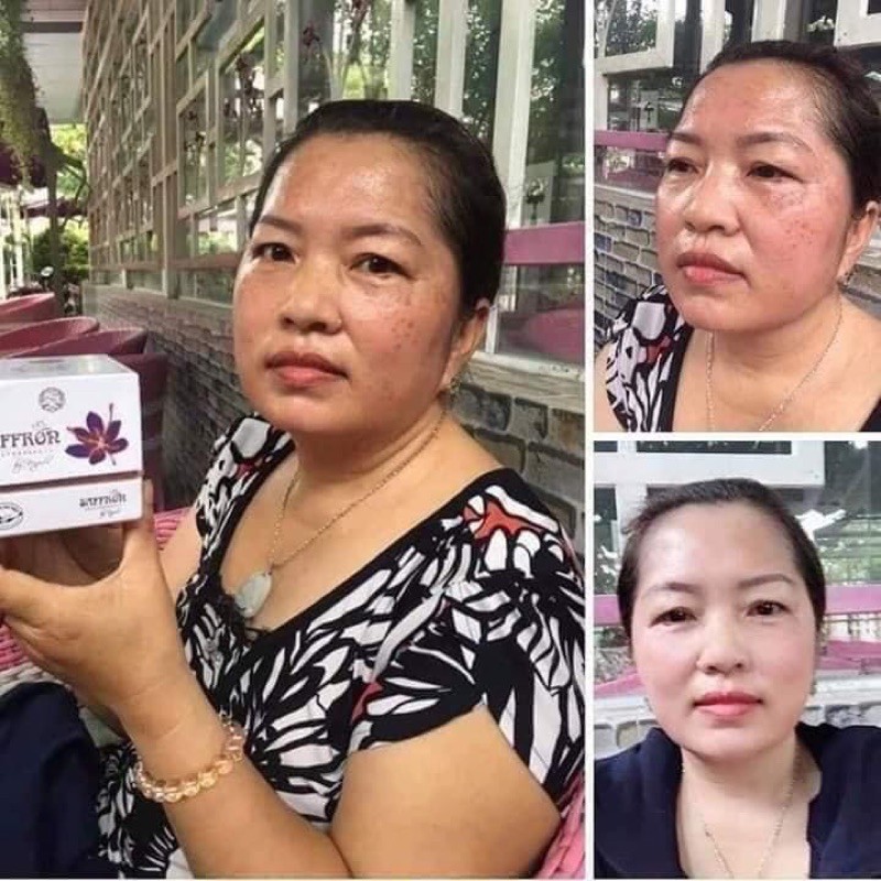 KEM MỜ NÁM TRẮNG DA SAFFRON | BigBuy360 - bigbuy360.vn