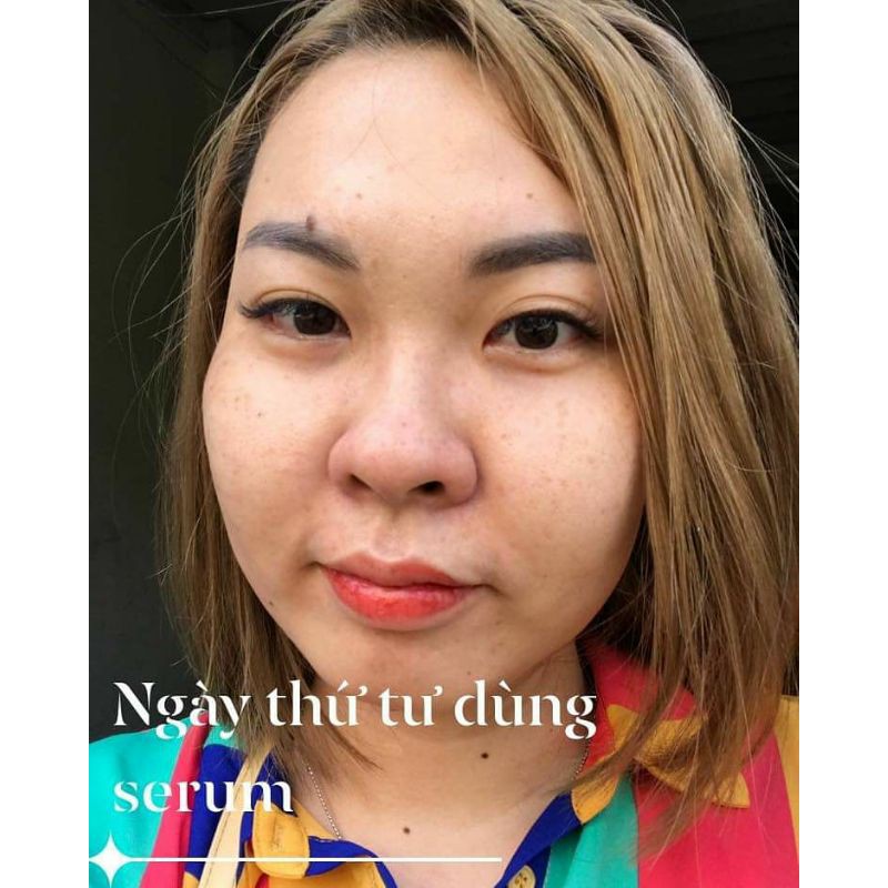 SERUM WHITENING BYUNHWAROUM TRẮNG DA- ĐÁNH BAY NÁM- TÀN NHANG HIỆU QUẢ