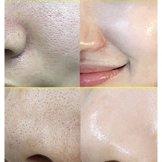 SERUM BOTOX MEDIPEEL