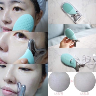 Máy rửa mặt cá Wellderma Hàn Quốc