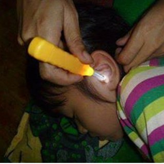 DỤNG CỤ LẤY RÁY TAI CÓ ĐÈN
