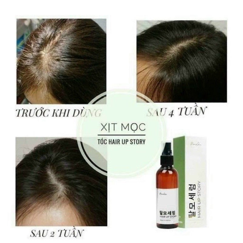 Xịt mọc tóc Genie Paris Choi Hair Up Story 💆