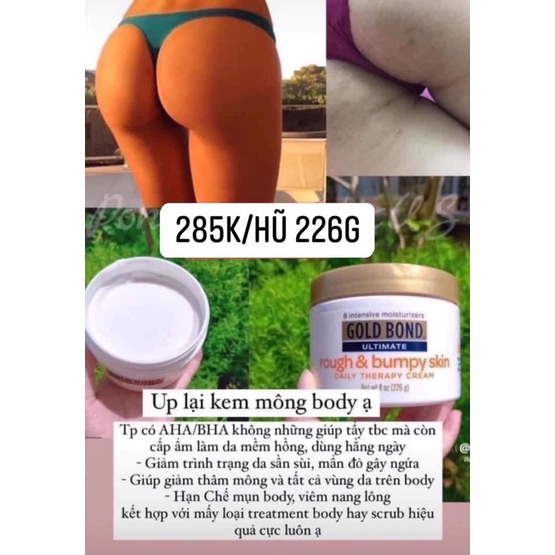 Kem dưỡng giảm viêm nang lông và mờ thâm mông bẹn nách khuỷu tay đầu gối gold bond