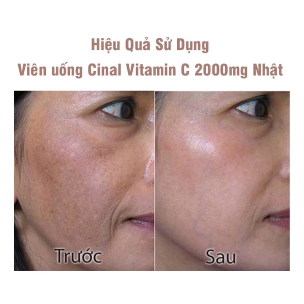 Viên uống Vitamin C TRẮNG DA, MỜ NÁM Cinal C Nhật Bản 100v | BigBuy360 - bigbuy360.vn