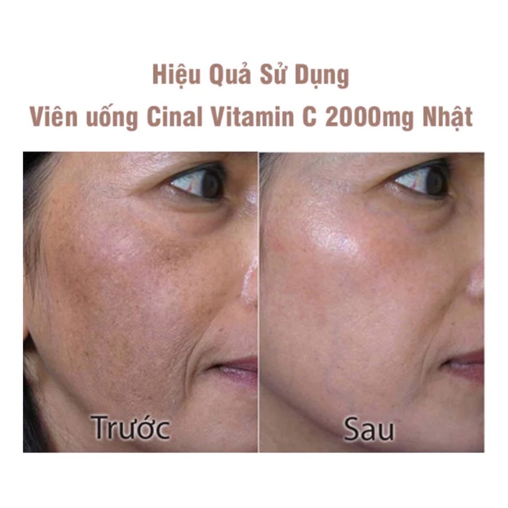 Viên uống Vitamin C TRẮNG DA, MỜ NÁM Cinal C Nhật Bản 100v