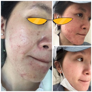 Sâm tái tạo đông y Hạnh Sinoo