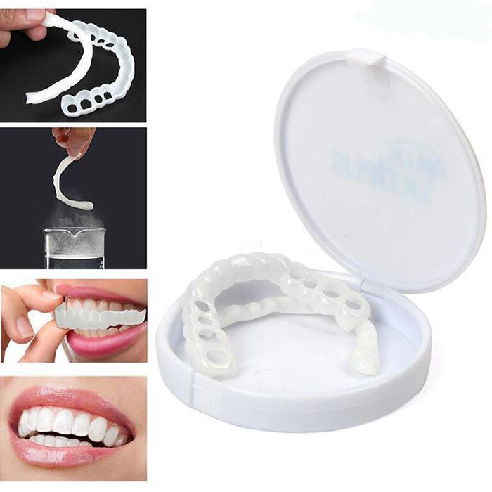 Dụng cụ niềng răng tại nhà snapon smile - nẹp răng tại nhà