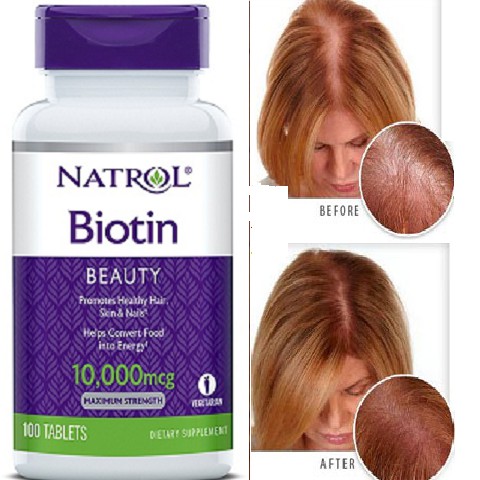 Biotin 10000 Mcg 100 Viên Của Mỹ Giúp mọc tóc giảm tóc gẫy ngăn rụng tóc | Thế Giới Skin Care