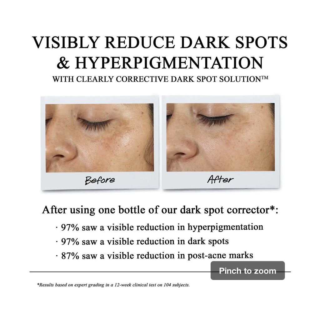 ⭐️Tinh Chất Serum Làm Sáng Da & Mờ Thâm Mụn Clearly Corrective™ Dark Spot Solution⭐️Size 50 ml ⭐️ | BigBuy360 - bigbuy360.vn