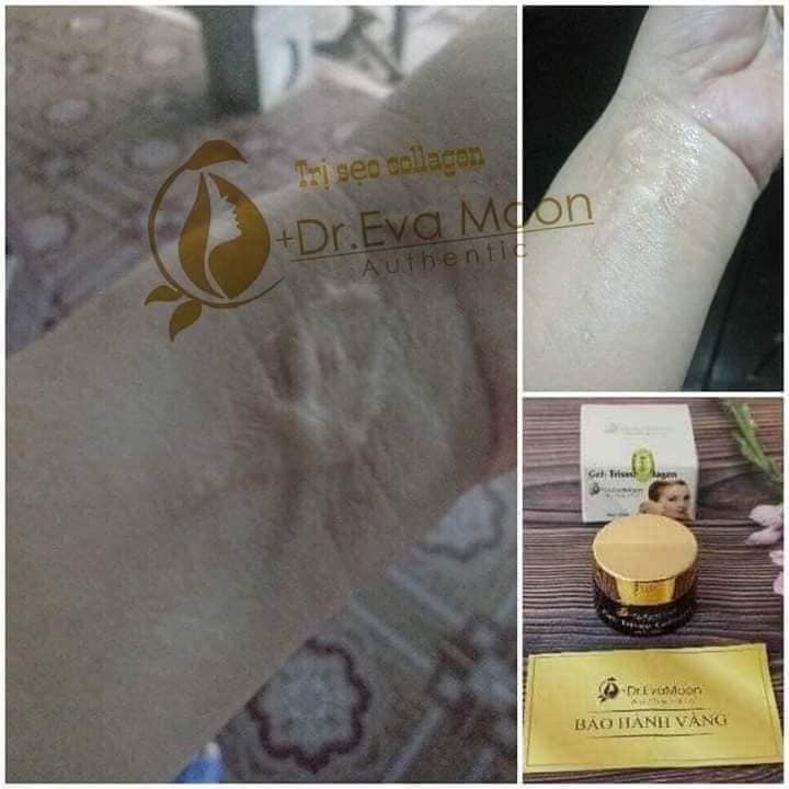 Kem Sẹo, Kem Sẹo Thâm, Rỗ Collagen Tươi Dr.EvaMoon