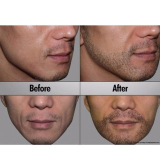Thuốc mọc râu Mensive Moustache & beard oilf