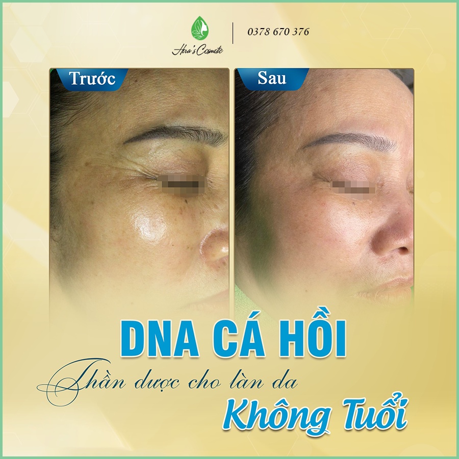 Tế bào gốc DNA cá hồi Idr skin_salmon PDNA Ampoule giúp căng bóng,trẻ hóa da