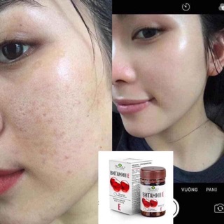 Vitamin E đỏ của Nga