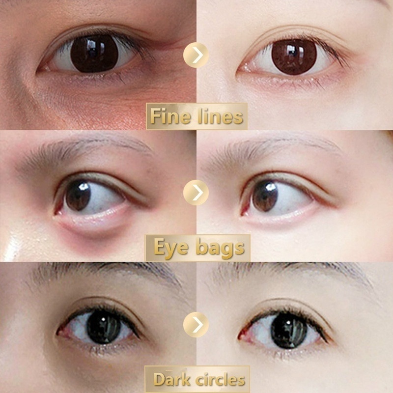 (Hàng Mới Về) Kem Dưỡng Da Mắt Săn Chắc Xóa Quầng Thâm Chống Nếp Nhăn | BigBuy360 - bigbuy360.vn