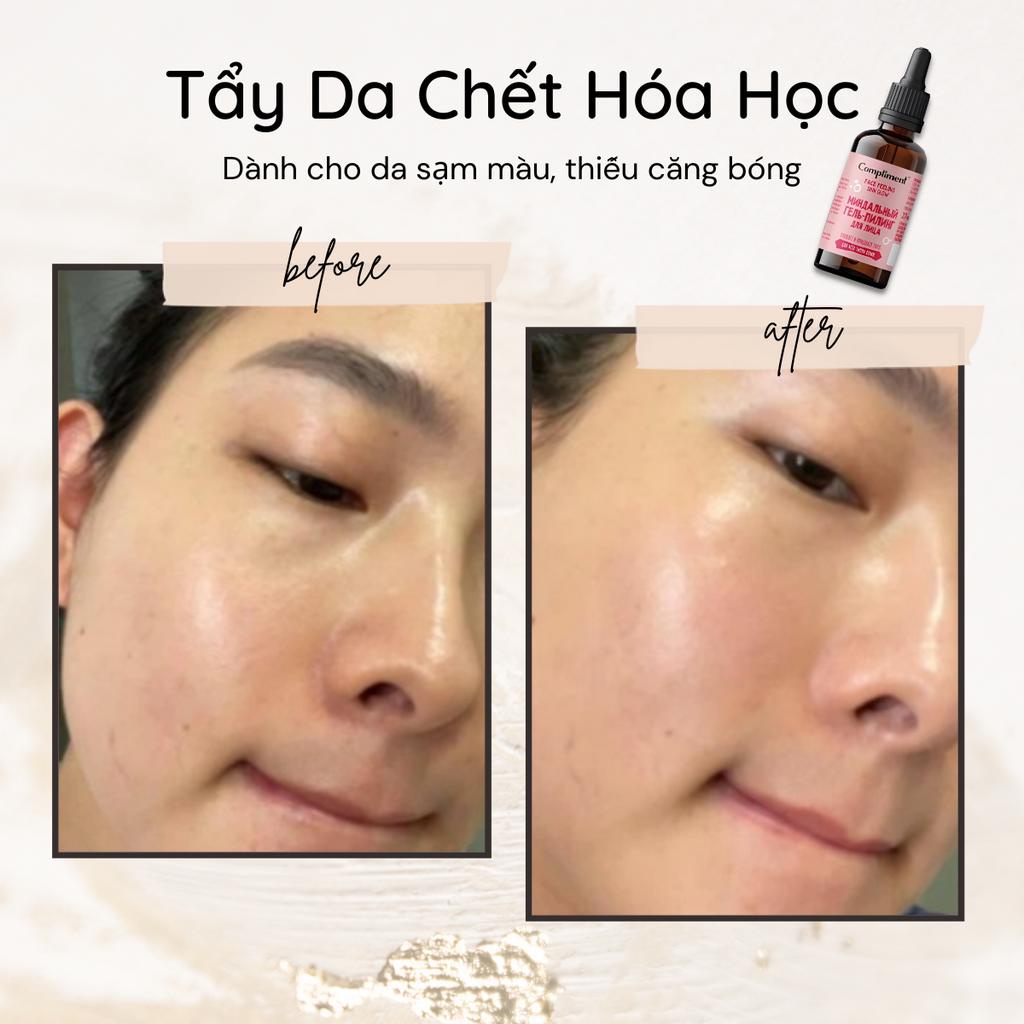 Tẩy Da Chết Hoá Học Peel Da Compliment Skin Glow Làm Sáng Và Căng Bóng Da 27ml