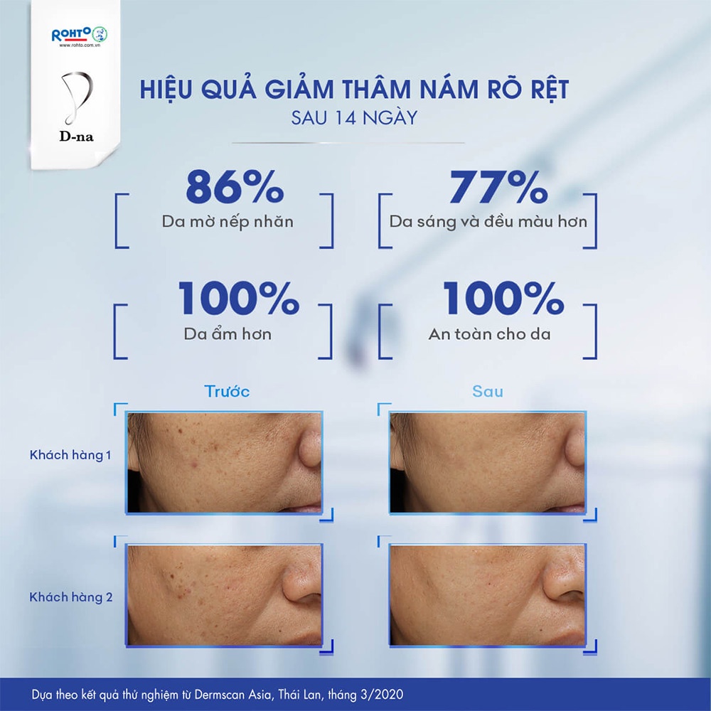 Kem Dưỡng D-Na Dưỡng Sáng Chuyên Sâu, Mờ Sạm Nám Ultimate Whitening Cream 50g