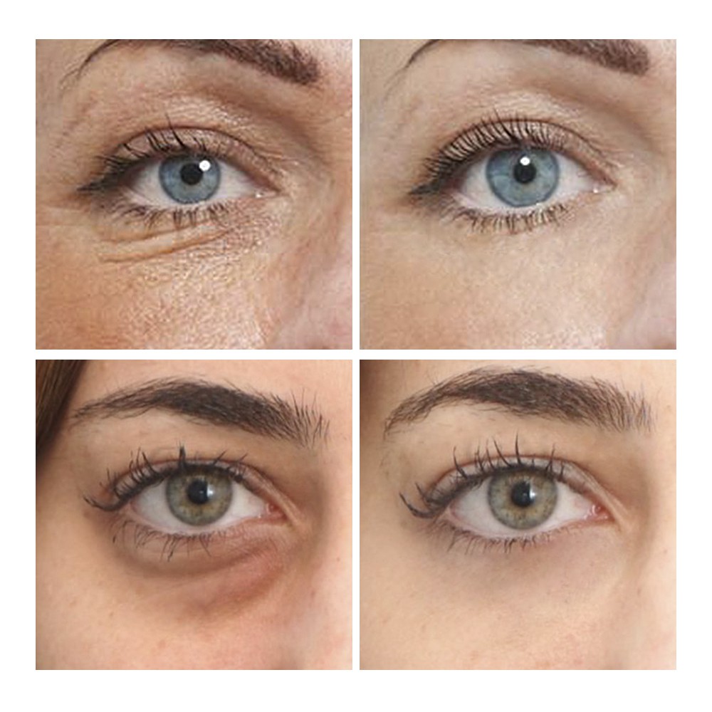 1 Cặp Mặt Nạ Mắt BREYLEE Chống Nếp Nhăn Lão Hoá Màu Xanh Lá Cây | BigBuy360 - bigbuy360.vn