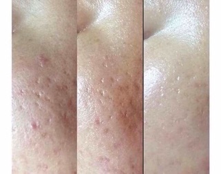 Kem trắng da vento truffle