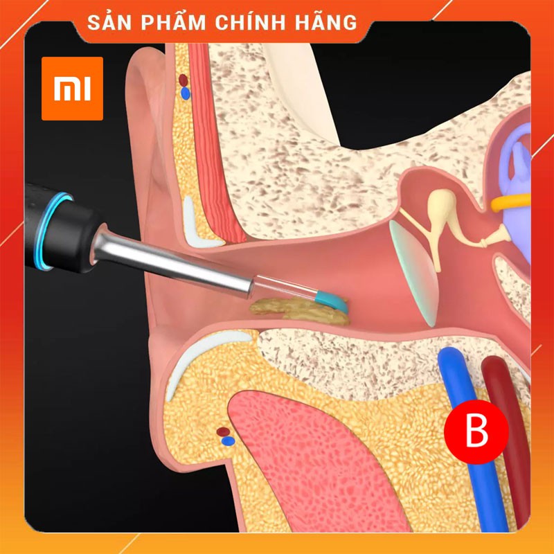 Bộ dụng cụ lấy ráy tai Xiaomi Bebird  có đèn và camera thông minh, an toàn