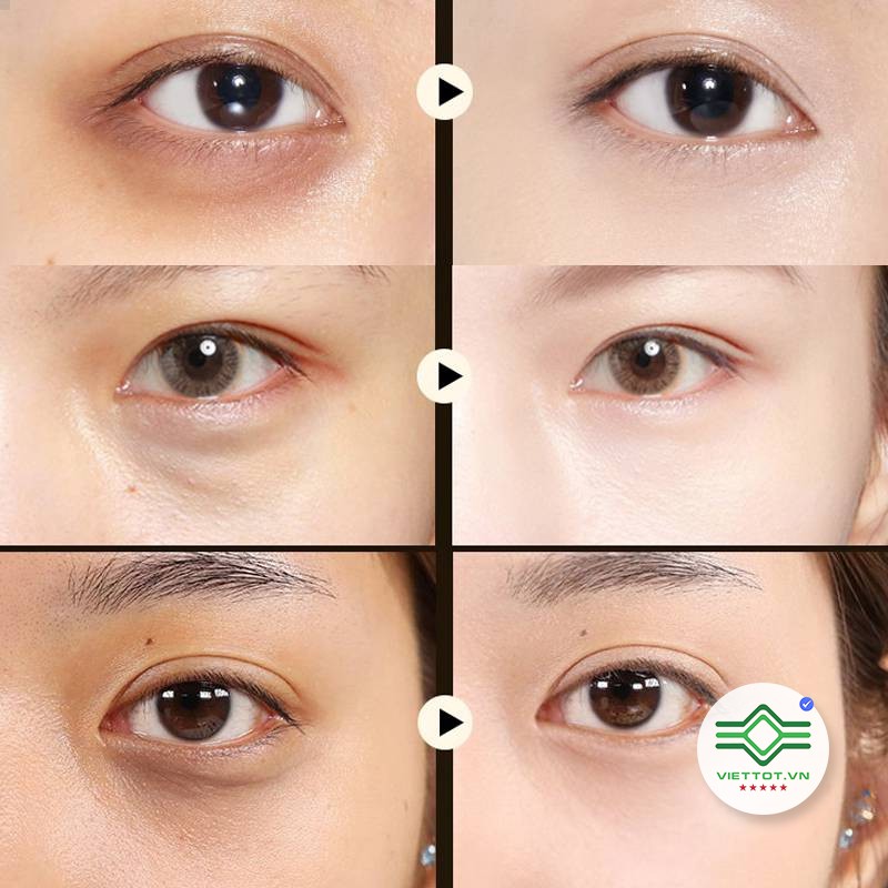 Một Hộp 60 miếng Mặt Nạ Mắt Images ALGA / GOLD Lady Series VT222 | BigBuy360 - bigbuy360.vn