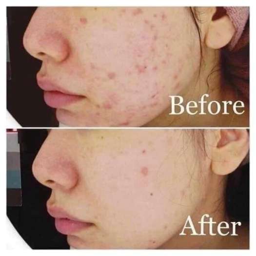 Sữa Rửa mặt KAYOKO PLUS TRẮNG SÁNG - MỊN MÀNG như gái Nhật Bản