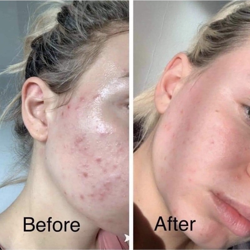 Sữa rửa mặt CeraVe dạng gel nhẹ dịu dành cho các loại da đủ size bản Mỹ