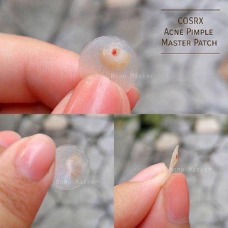 Miếng Dán Mụn Cosrx Acne pimple master Patch (24 miếng)