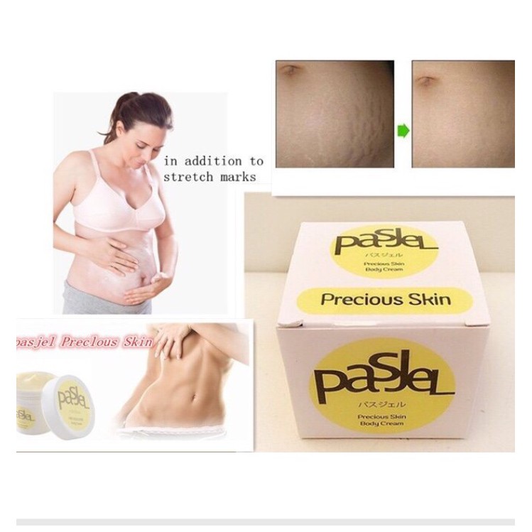 Kem Trị Rạn Da Pasjel Thái Lan