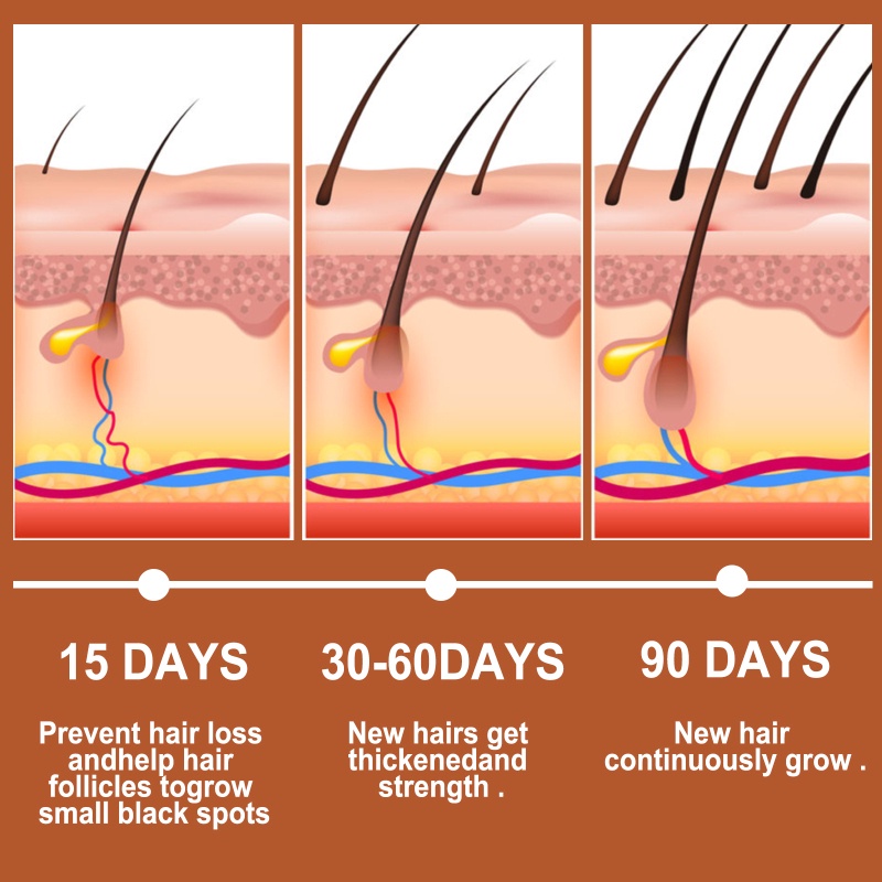 Eelhoe Serum Mọc Tóc 30Ml Serum Mọc Tóc  -rốc Chăm Sóc Đầu-Ampere