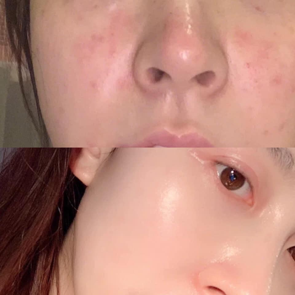 Collagen lựu đỏ 💝 FREESHIP 💝 Bột uống bổ sung Collagen lựu đỏ Hàn Quốc bio cell trẻ hóa da, căng bóng hộp 30 gói | BigBuy360 - bigbuy360.vn