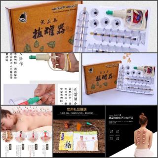 BỘ GIÁC HƠI 24 CỐC HÀNG CHUẨN KHÔNG DÙNG LỬA