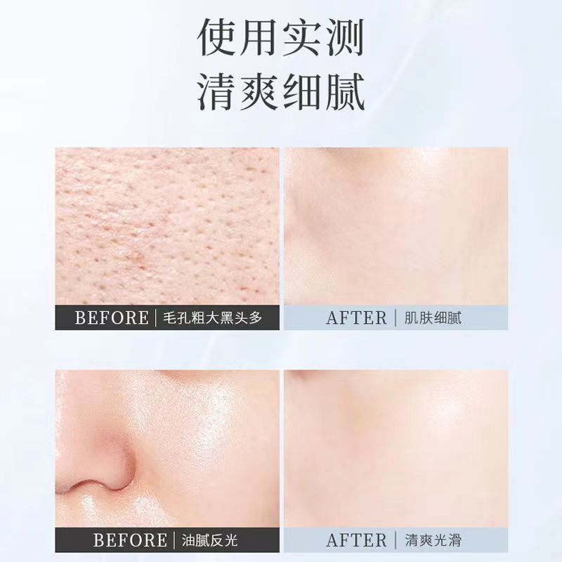 Auou Mặt nạ đất sét làm sạch sâu làm trắng da đa tác dụng