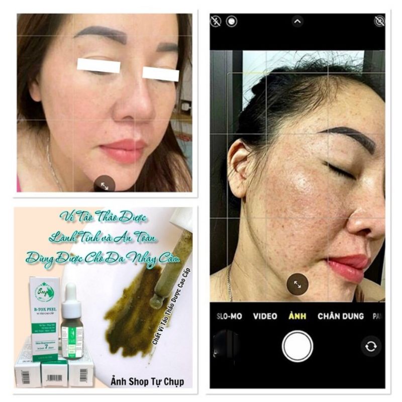 Peel Hút Nám Bong Da Vi Tảo Trắng Da Bezy Cao Cấp