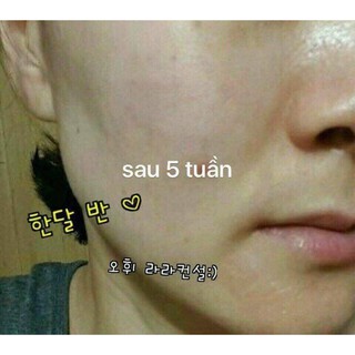 Combo 50 gói Tinh Chất Vàng OHUI The First