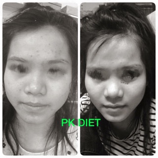 Kem tan mỡ mặt Vline PK Diet