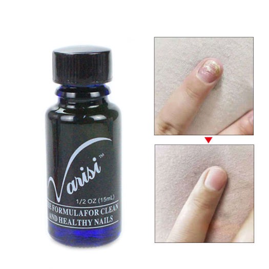 Dung dịch cải thiện nấm móng Varisi Nail